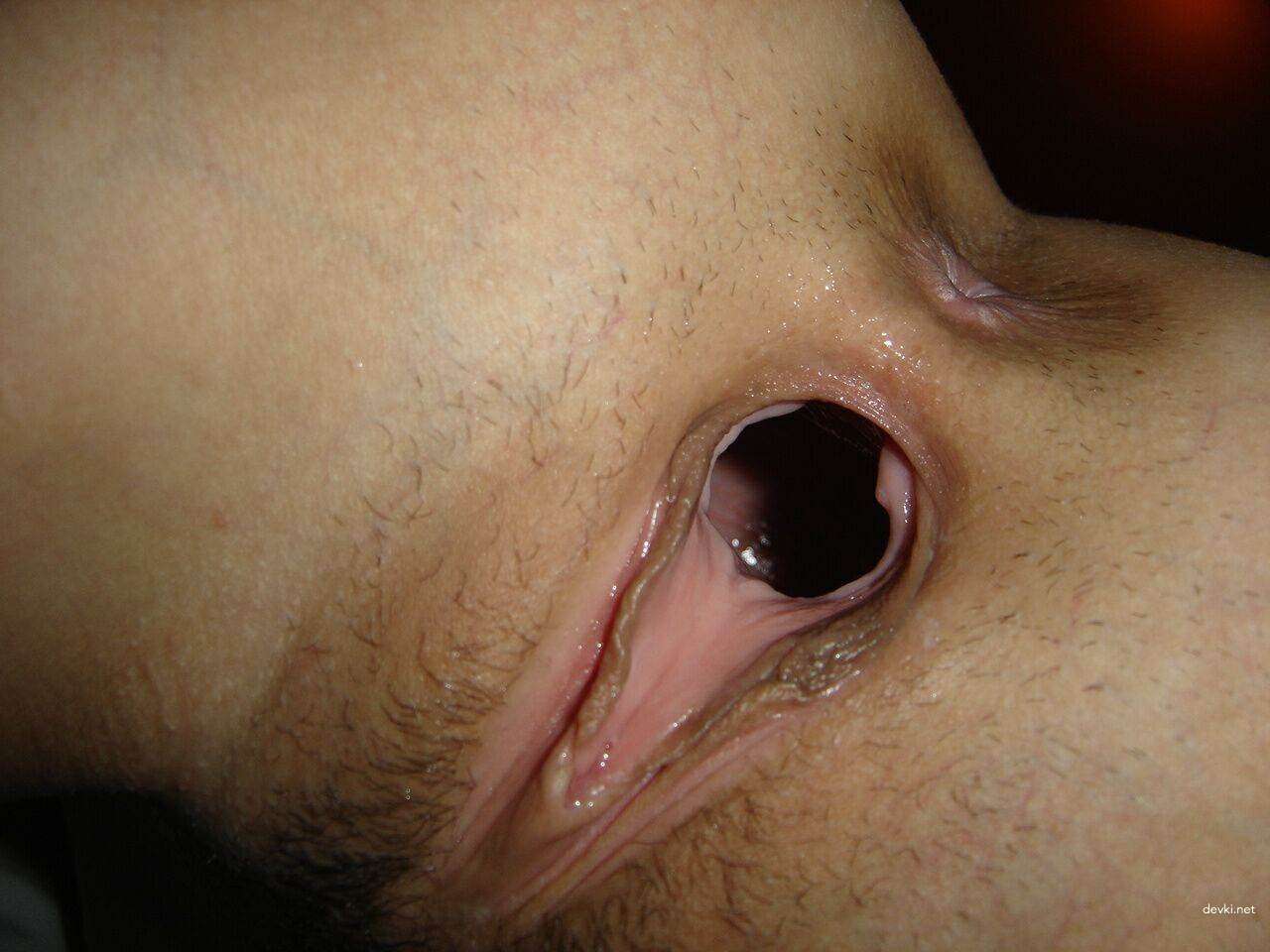 Fully Stretched Holes: Extreme Anal and Vaginal Penetration Photo