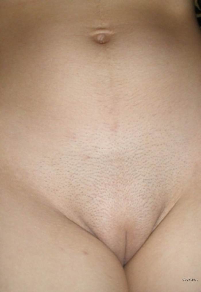 Explicit Amateur Photo: Young Girl with Shaved Pubic Area